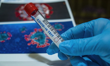 Коронавирус в Ленобласти: за последние сутки выявлено 182 новых случая