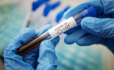 Коронавирус в Ленобласти: за последние сутки выявлено 345 новых случаев