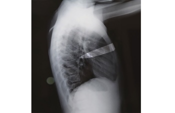 Восемь лет с ножом в груди