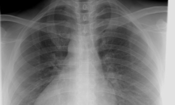 «Мое сердце! Почки!»